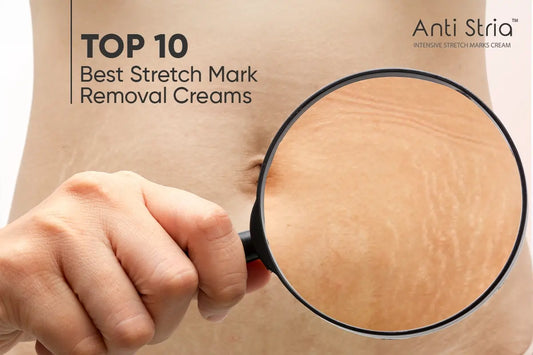 Unveiling The Top 10 Stretch Mark Removal Creams For 2023
