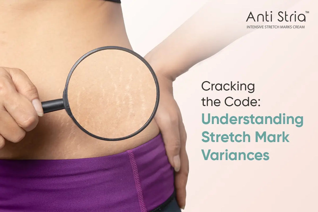 UNDERSTANDING THE SCIENCE BEHIND STRETCH MARKS: WHY SOME PEOPLE GET THEM AND OTHERS DON’T
