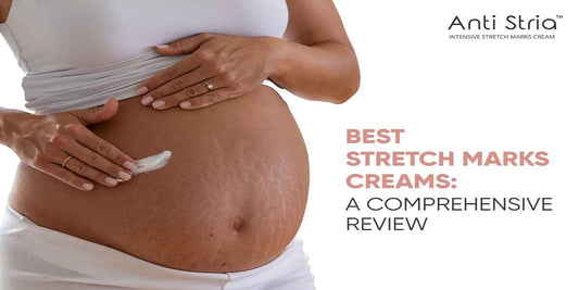 Best Stretch Marks Removal Cream: A Comprehensive Review