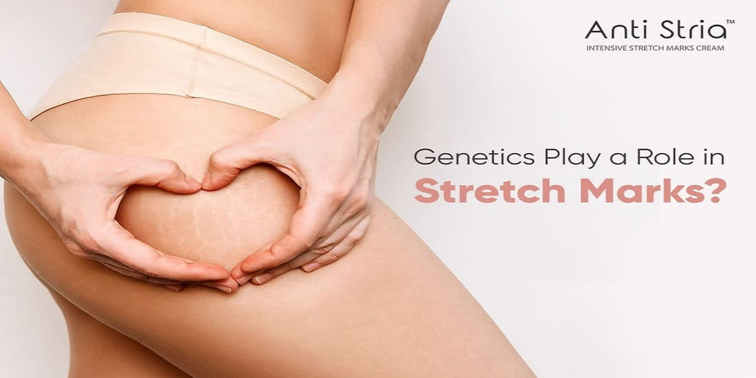 Does Genetics Play a Role in Stretch Marks? Here’s What Pregnant Women Should Know.