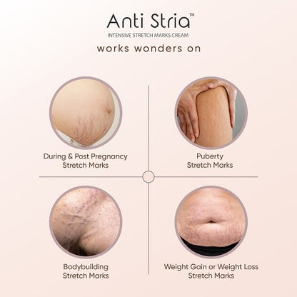 Best Stretch Marks Removal