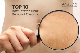 Stretch Mark Creams
