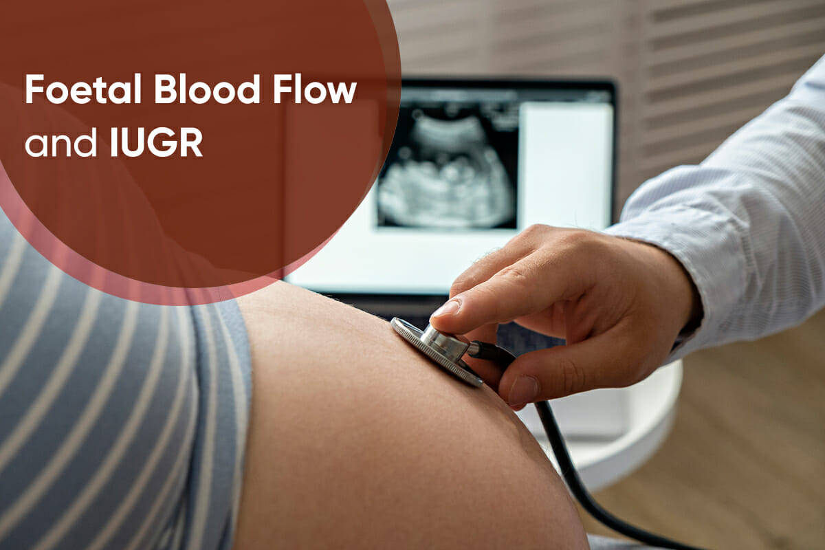 foetal blood flow resistance