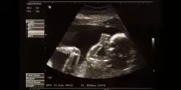 Prenatal Supplementation