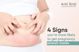 Anti Stria Best product for Pregnancy Stretch Marks Removal