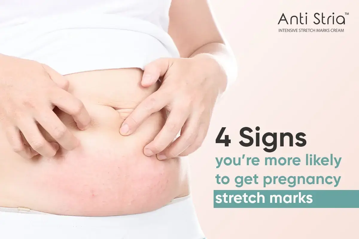 4 Signs You're More Likely to Get Pregnancy Stretch Marks