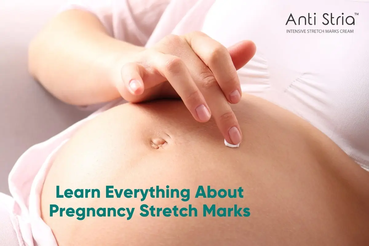 WHAT ARE PREGNANCY STRETCH MARKS
