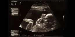 Fifth Month of Pregnancy
